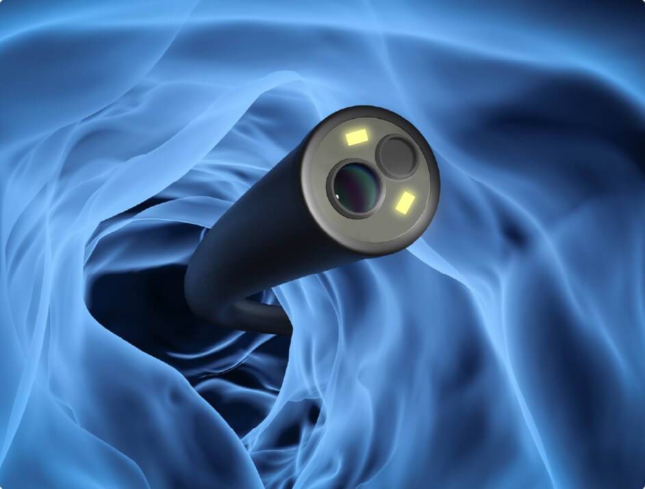 纤维支气管镜与电子支气管镜：哪个更适合您的医疗需求？鼹鼠医疗替您解答